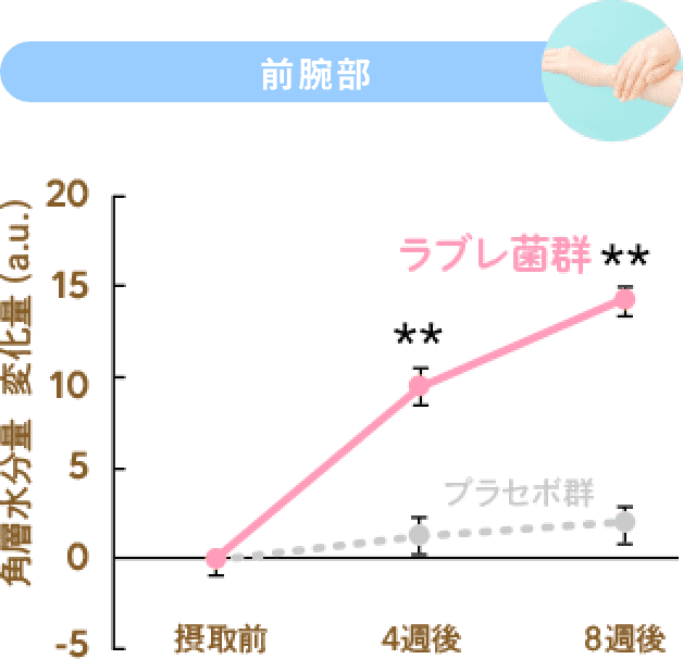 前腕部